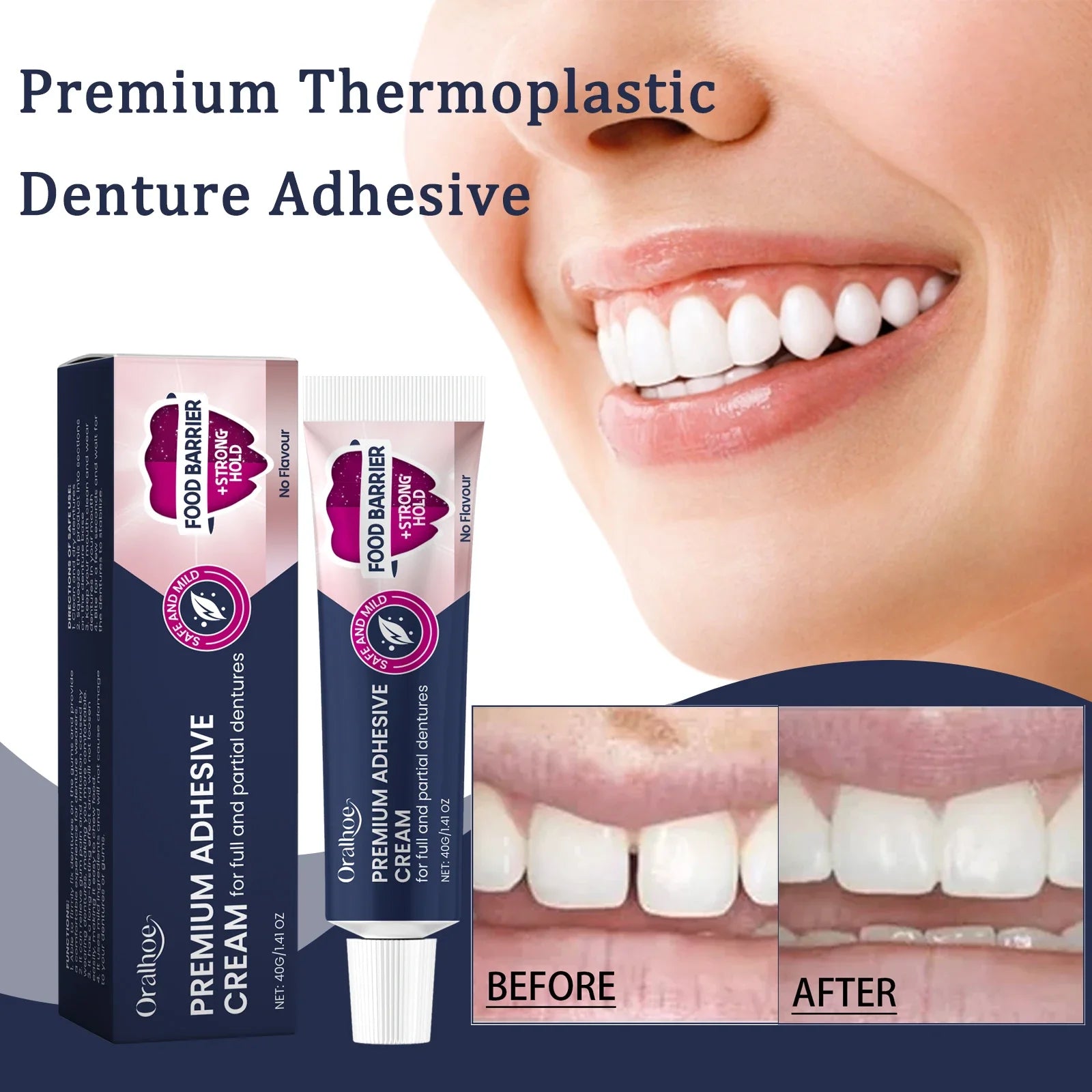 Premium Thermoplastic Denture Adhesive Long Lasting Denture Fixing Adhesive for Filling Fix Missing/Broken Tooth False Teethglue
