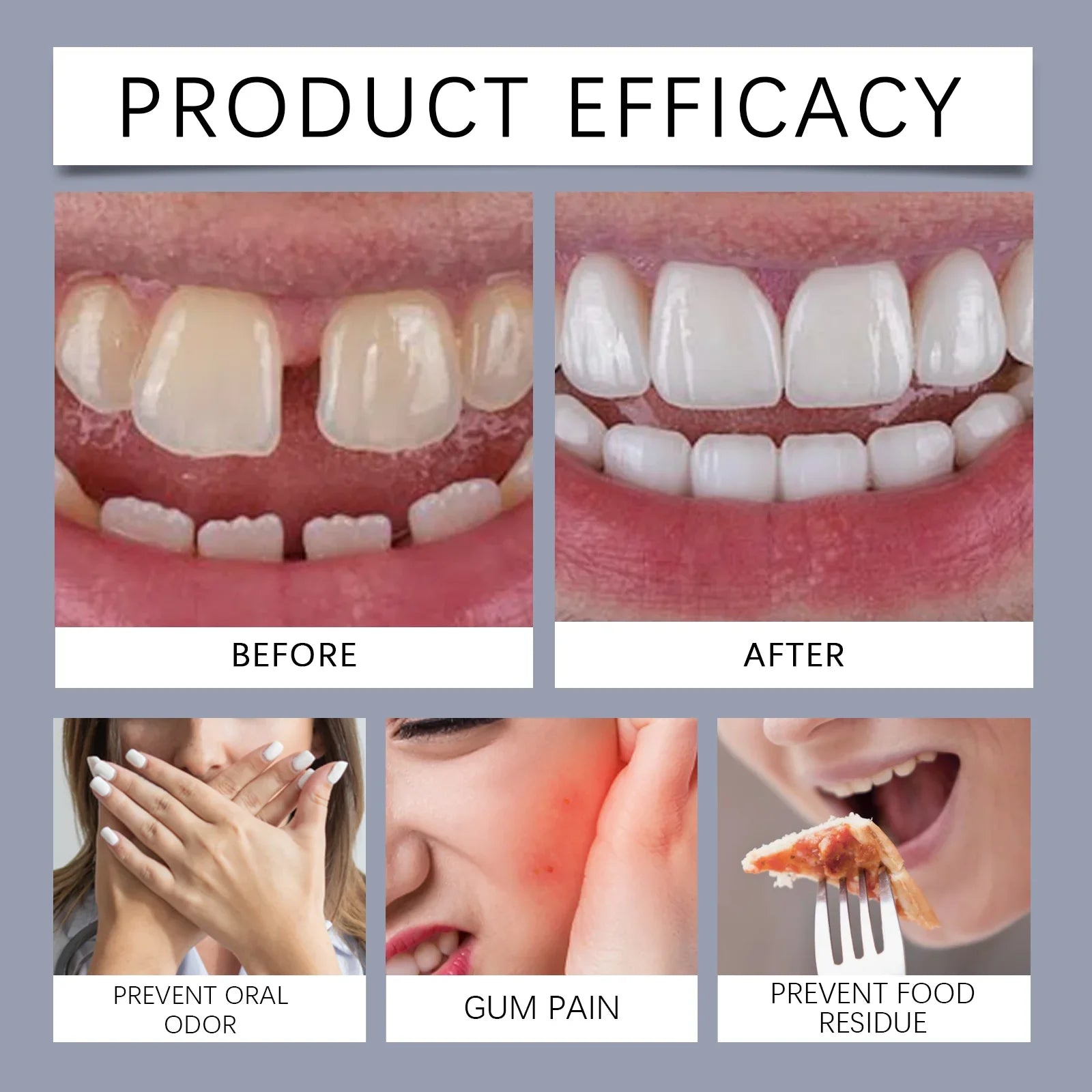 Premium Thermoplastic Denture Adhesive Long Lasting Denture Fixing Adhesive for Filling Fix Missing/Broken Tooth False Teethglue